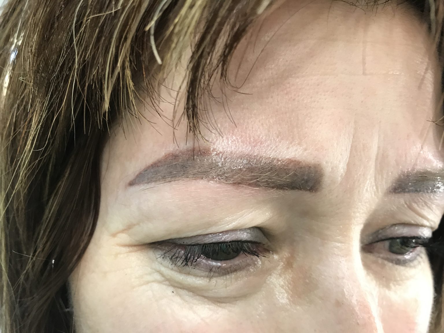 Выведение перманентного макияжа. Заживление после ремувера ...