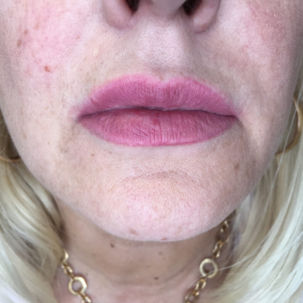 permanentnyj makijazh i kozha s rozacea