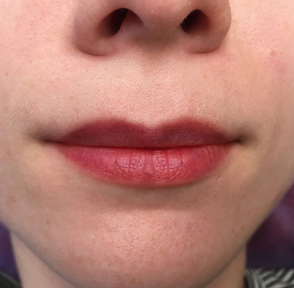 Исправленный перманентный макияж губ после неудачной процедуры татуажа