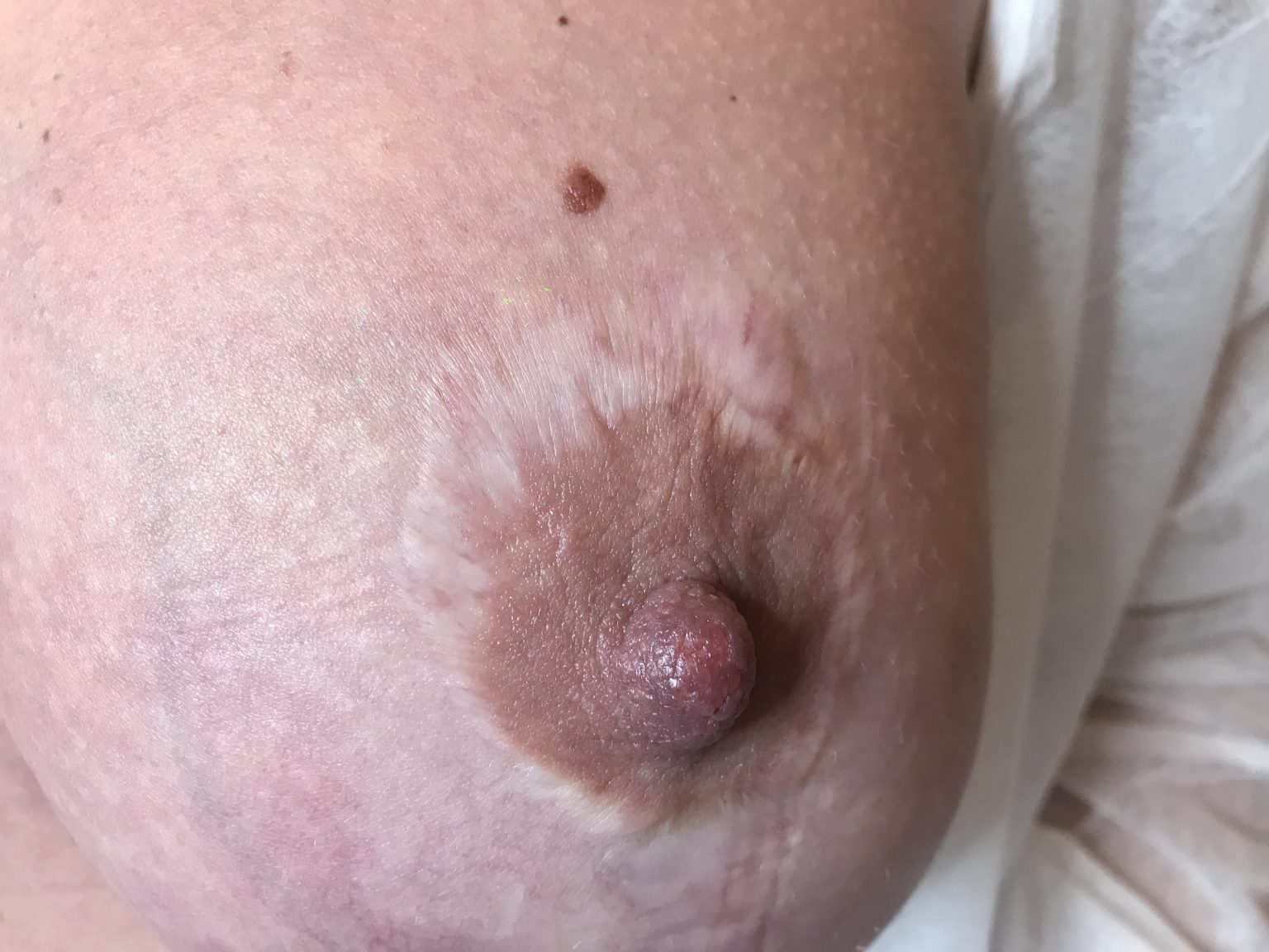 грудь при беременности ареолы фото 72